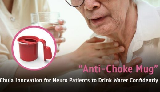 朱拉医学院研发出神经疾病患者专用的防噎杯，让喝水更安全