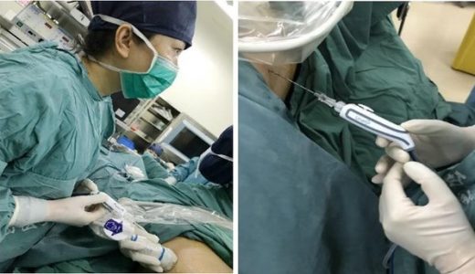 原创Liwen RF(TM)射频消融及心肌活检系统带来肥心病诊治创新策略