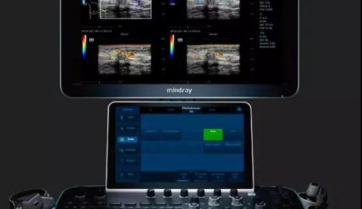 迈瑞“彩色多普勒超声系统”进入了创新医疗器械特别审查阶段