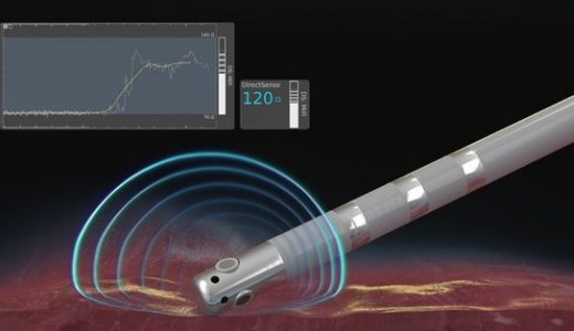 波士顿科学推出DIRECTSENSE(TM)技术