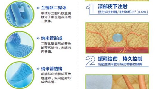 醋酸兰瑞肽缓释注射液(预充式)上市 开启肢端肥大症全新治疗时代