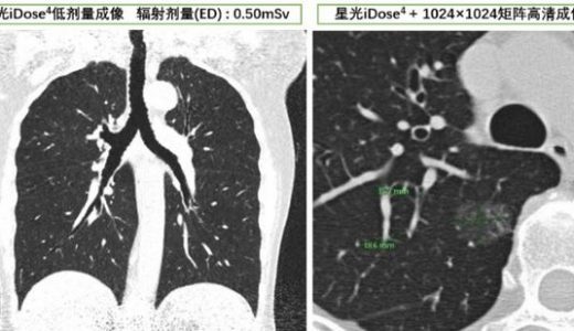 飞利浦智创科技,助力基层抗疫
