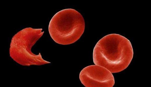 邦耀生物攻克重度“地贫”