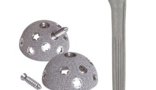 施乐辉的REDAPT(TM)全髋关节翻修术系统将会进入中国市场