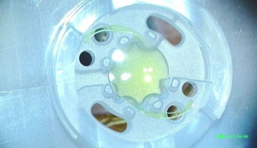 爱尔康新一代老视矫正型人工晶状体Vivity在博鳌完成首例植入