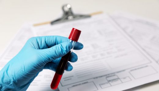 NICE发布创新简报介绍精准无创前列腺癌诊断