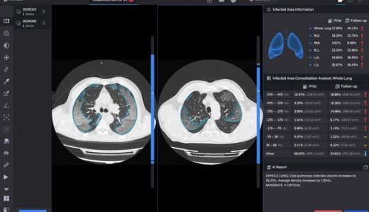 推想医疗AI助力欧盟委员会监测新冠变异毒株