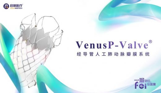 启明医疗VenusP-Valve获中国NMPA批准上市