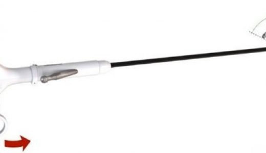 博鳌首例一次性电子膀胱镜落地