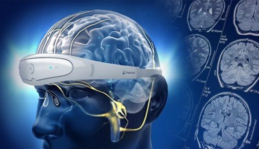 神经技术领导者Neurolief获得战略投资，推动偏头痛和抑郁症电疗法的发展