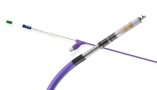 INGEVITY+心脏起搏电极导线新适应证获批，提升心室同步性与安全性