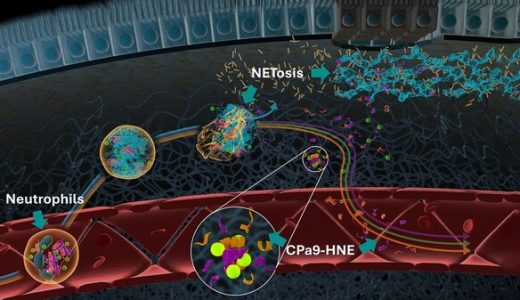 CPa9-HNE生物标志物获FDA认可，Nordic Bioscience推进炎症性肠病精准医疗