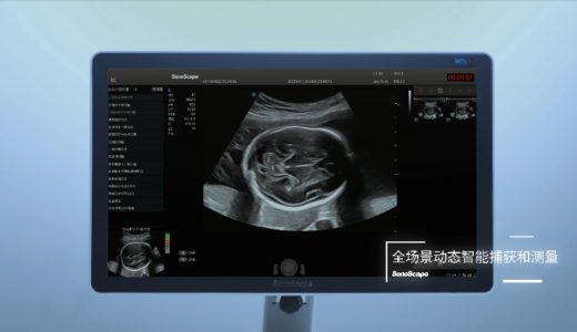开立医疗拿下国内首个产前超声人工智能医疗器械证