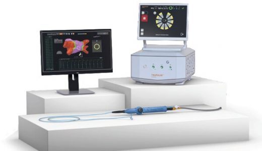 强生医疗科技VARIPULSE国内首批百例手术顺利完成