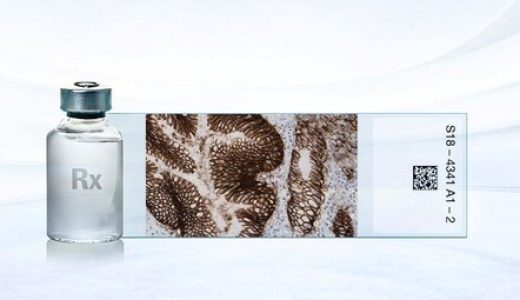 威络益伴随诊断试剂(CLDN18) 获批