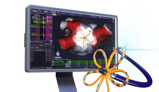 波士顿科学全新OPAL HDx™三维标测系统在华正式获批