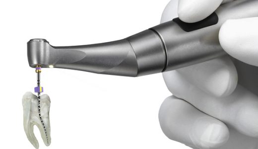 登士柏西诺德推出集成根尖定位功能的X-Smart Pro+根管预备机